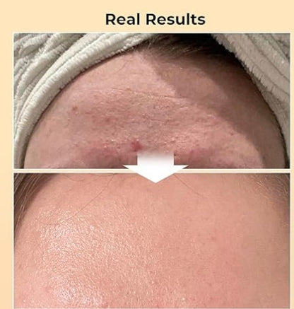 Korean Snail Mucin Facial Essence - Anti-Aging & Brightening