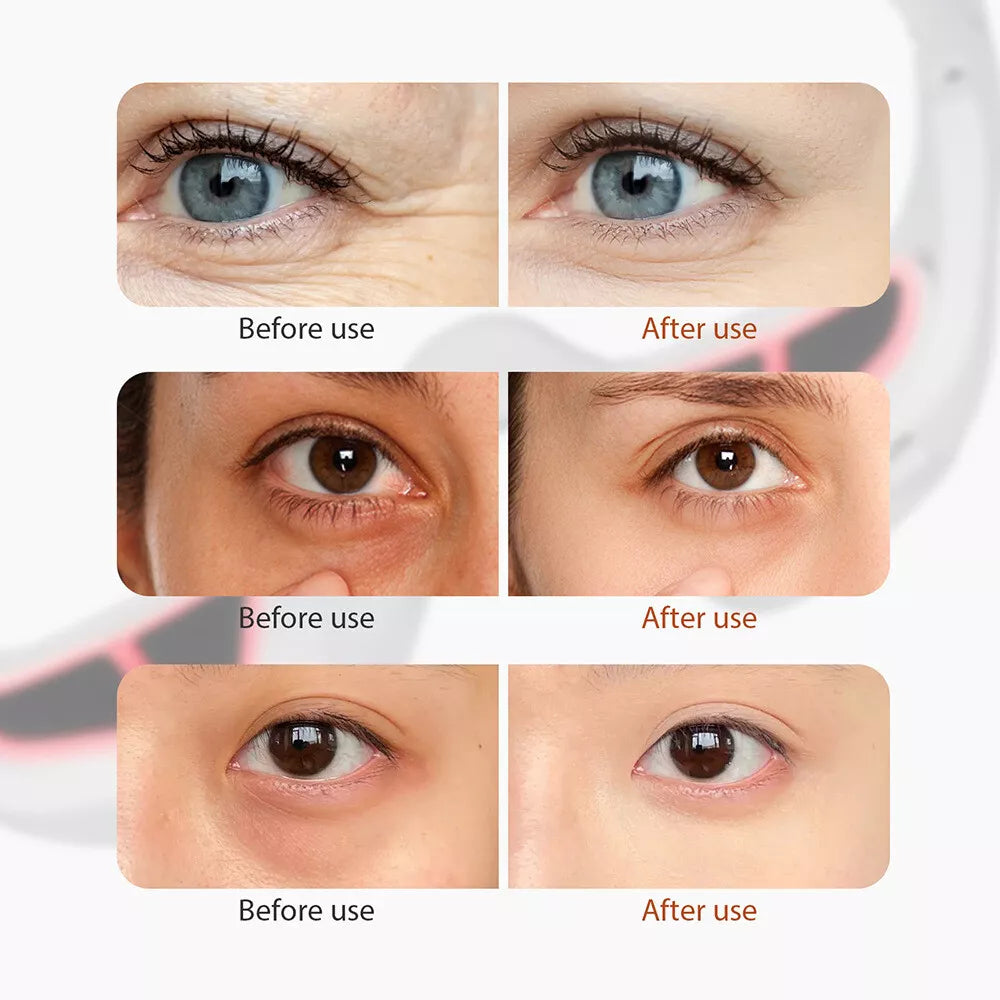 Radiance Revive Red light Eye massager